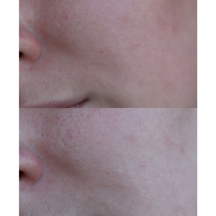 شوینده سراوی کنترل کننده و ضد لک مدل Salicylic Acid Cleanser حجم ۴۷۳میلی لیتر کپی
