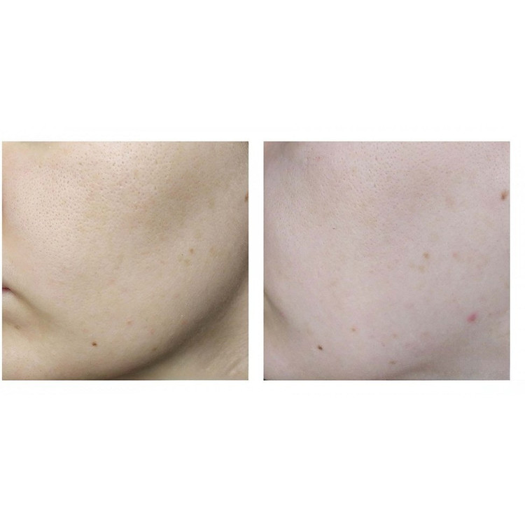 شوینده سراوی کنترل کننده و ضد لک مدل Salicylic Acid Cleanser حجم ۴۷۳میلی لیتر کپی