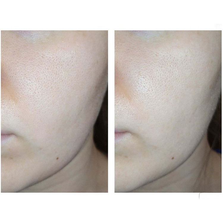 شوینده سراوی کنترل کننده و ضد لک مدل Salicylic Acid Cleanser حجم ۴۷۳میلی لیتر کپی