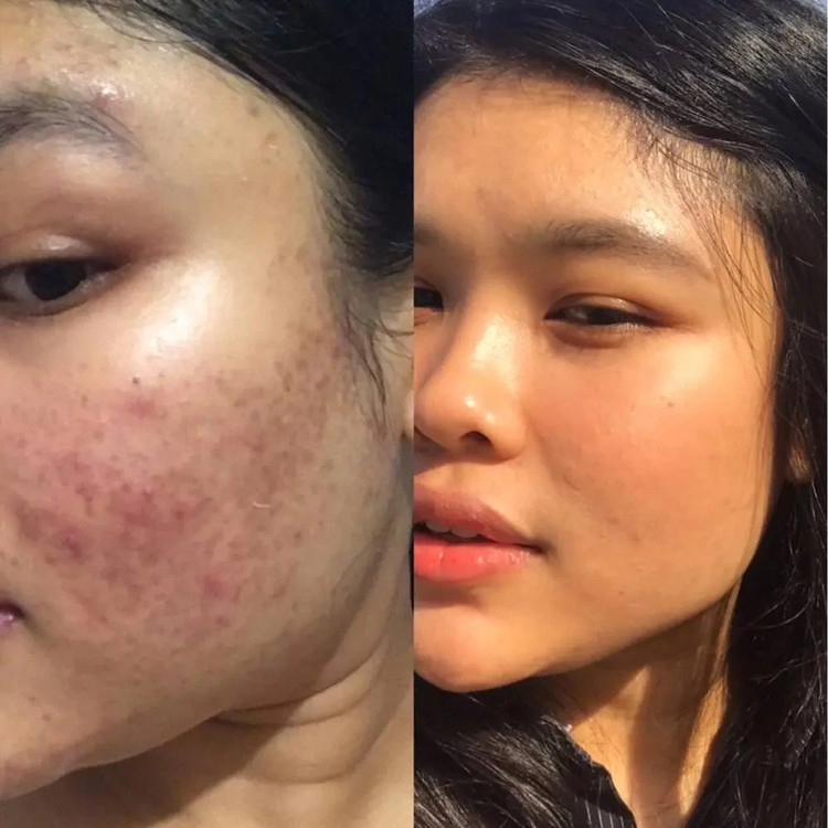 شوینده سراوی کنترل کننده و ضد لک مدل Salicylic Acid Cleanser حجم ۴۷۳میلی لیتر کپی
