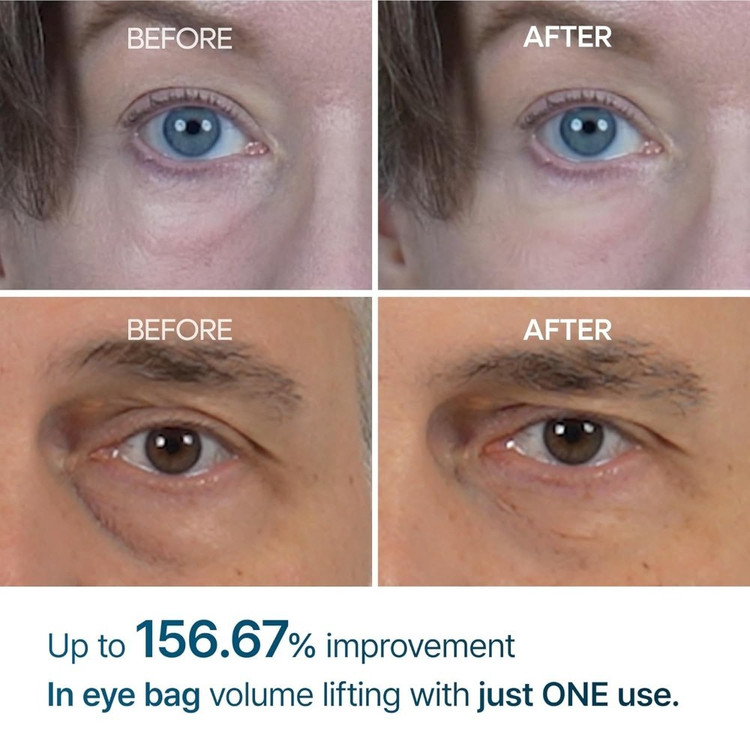 کرم دور چشم دکتر ملاکسین مدل Eyephalt حجم ۱۰ میلی لیتر ضد چروک و روشن کننده( کپی)
