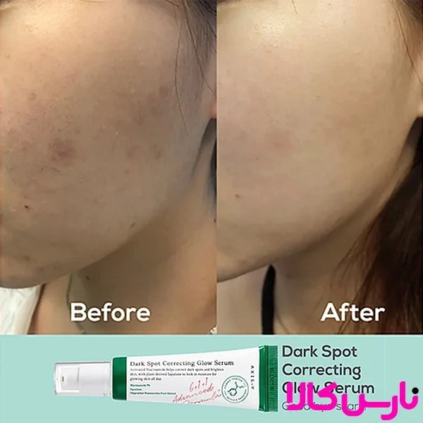 سرم ضد لک و روشن کننده Dark Spot حجم ۵۰ میل های کپی(مستر)