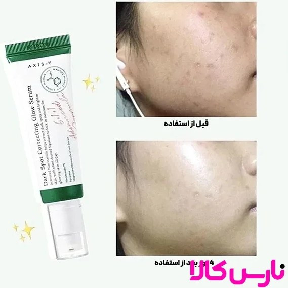 سرم ضد لک و روشن کننده Dark Spot حجم ۵۰ میل های کپی(مستر)